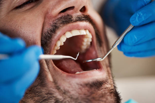 Best Emergency Dental Extractions in Kana, UT